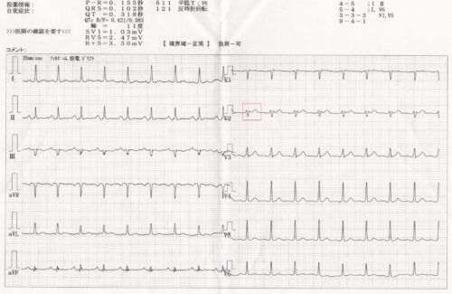 20240816_心電図